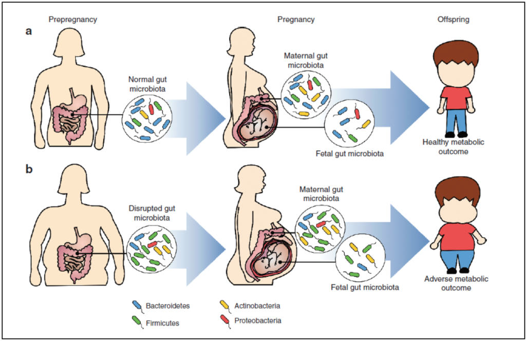 Maternal obesity and the gut microbiome | MothersBabies